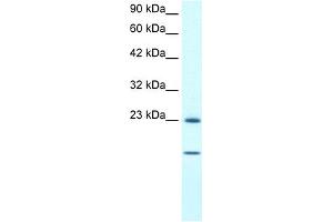 WB Suggested Anti-HSPB1 Antibody Titration:  1. (HSP27 Antikörper  (C-Term))