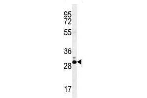 CT45A antibody western blot analysis in K562 lysate (CT45A1 Antikörper  (AA 1-30))