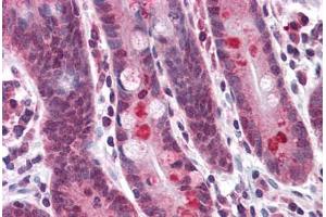 Human Small Intestine: Formalin-Fixed, Paraffin-Embedded (FFPE) (Anoctamin 2 Antikörper  (N-Term))