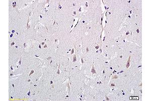 Formalin-fixed and paraffin embedded rat brain labeled with Anti-CD146/MCAM Polyclonal Antibody, Unconjugated (ABIN732143) at 1:400 followed by conjugation to the secondary antibody and DAB staining (MCAM Antikörper  (AA 201-300))
