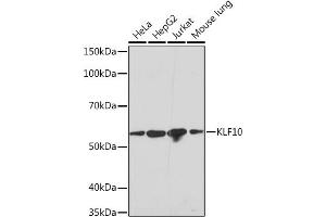 Western blot analysis of extracts of various cell lines, using KLF10 Rabbit mAb (ABIN7268150) at 1:1000 dilution. (KLF10/TIEG1 Antikörper)