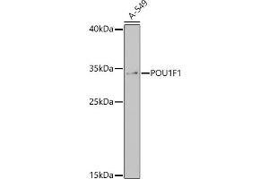 POU1F1 Antikörper