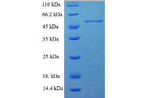 SDS-PAGE (SDS) image for Milk Fat Globule-EGF Factor 8 Protein (MFGE8) (AA 24-387) protein (His-SUMO Tag) (ABIN5709927) (MFGE8 Protein (AA 24-387) (His-SUMO Tag))