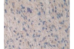 Immunohistochemistry (IHC) image for anti-Mitogen-Activated Protein Kinase-Activated Protein Kinase 2 (MAPKAPK2) (AA 139-367) antibody (ABIN7441769)