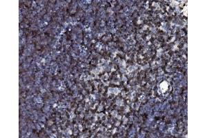 IHC analysis of Cd2 using anti-Cd2 antibody (ABIN7600738).