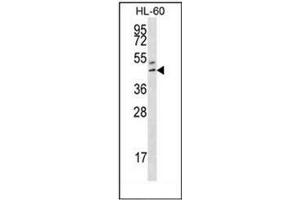 Western blot analysis of HOXB3 / HOX2G Antibody (Center) in HL-60 cell line lysates (35ug/lane). (HOXB3 Antikörper  (Middle Region))