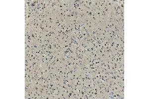 IHC analysis of SNRNP27 using anti-SNRNP27 antibody (ABIN7599614). (SNRNP27 Antikörper  (AA 100-155))