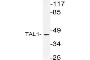 Western blot analysis of TAL1 Antibody in extracts from Jurkat cells. (TAL1 Antikörper)
