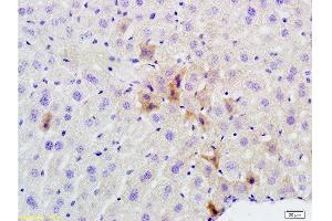 Formalin-fixed and paraffin embedded mouse liver labeled with Rabbit Anti phospho-GCN2 (Thr667) Polyclonal Antibody, Unconjugated  at 1:200 followed by conjugation to the secondary antibody and DAB staining (GCN2 Antikörper  (pThr667))