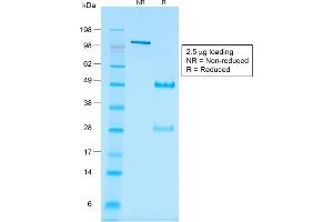 SDS-PAGE Analysis Purified Wilm's Tumor Mouse Recombinant Monoclonal Antibody (rWT1/857). (Rekombinanter WT1 Antikörper)