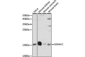 Western blot analysis of extracts of various cell lines, using SDH antibody (ABIN7270619) at 1:1000 dilution. (Sdhaf2 Antikörper  (AA 1-166))