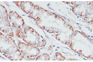 Immunohistochemistry of paraffin-embedded Human stomach using ACSL3 Polyclonal Antibody at dilution of 1:100 (40x lens).
