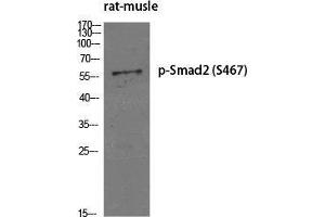 Western Blot (WB) analysis of specific cells using Phospho-Smad2 (S467) Polyclonal Antibody. (SMAD2 Antikörper  (pSer467))