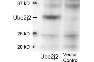 Image no. 1 for anti-Ubiquitin-Conjugating Enzyme E2, J2 (UBE2J2) (Internal Region) antibody (ABIN401475) (UBE2J2 Antikörper  (Internal Region))