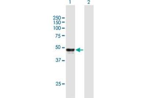 Western Blot analysis of SERPINH1 expression in transfected 293T cell line by SERPINH1 MaxPab polyclonal antibody. (SERPINH1 Antikörper  (AA 1-418))