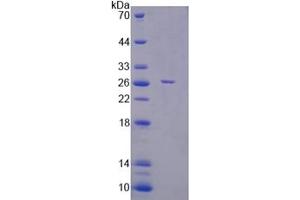 Image no. 1 for F-Box Protein 32 (FBXO32) (AA 1-201) protein (His tag) (ABIN6237452)