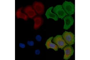 ABIN6257450 and ABIN6275471 staining Hela cells(30 min of UV treatment) by IF/ICC.