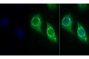 Detection of CK19 in Human Hela cell using Monoclonal Antibody to Cytokeratin 19 (CK19) (Cytokeratin 19 Antikörper  (AA 245-391))