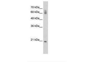 Image no. 1 for anti-FIP1 Like 1 (FIP1L1) (AA 509-558) antibody (ABIN6736286)
