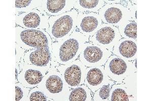 IHC analysis of VDAC3 using anti-VDAC3 antibody (ABIN7602541).