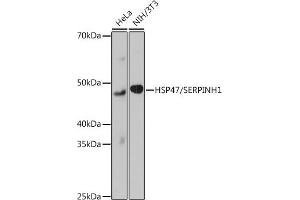 Western blot analysis of extracts of various cell lines, using HSP47/SERPINH1 Rabbit mAb (ABIN7270238) at 1:1000 dilution. (SERPINH1 Antikörper)