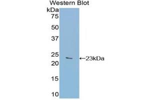 Western blot analysis of the recombinant protein. (GAA Antikörper  (AA 782-953))