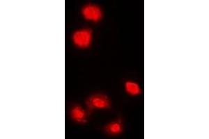 Immunofluorescent analysis of AMPK alpha 1 staining in HeLa cells. (PRKAA1 Antikörper  (C-Term))