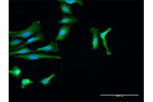 Immunofluorescence of purified MaxPab antibody to PTPN2 on HeLa cell. (PTPN2 Antikörper  (AA 1-387))