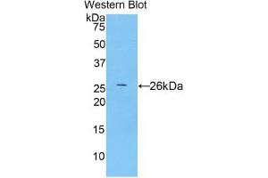 Detection of Recombinant TLR5, Human using Polyclonal Antibody to Toll Like Receptor 5 (TLR5) (TLR5 Antikörper  (AA 693-858))