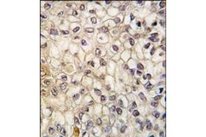 Image no. 2 for anti-Cytochrome P450, Family 2, Subfamily F, Polypeptide 1 (CYP2F1) (AA 402-432), (C-Term) antibody (ABIN360249)