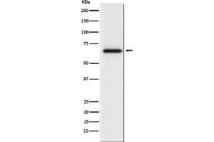 Western blot analysis of MMP2 expression in L6 cell lysate.