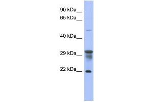 WB Suggested Anti-PMM1 Antibody Titration: 0. (PMM1 Antikörper  (N-Term))