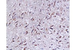 Formalin-fixed and paraffin embedded rat brain tissue labeled with Anti-SYP p38/Synaptophysin/SAP-1 Polyclonal Antibody, Unconjugated  at 1:200, followed by conjugation to the secondary antibody and DAB staining (SYAP1 Antikörper  (AA 151-230))
