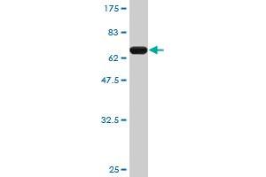 Western Blot detection against Immunogen (65. (PCBP2 Antikörper  (AA 1-362))