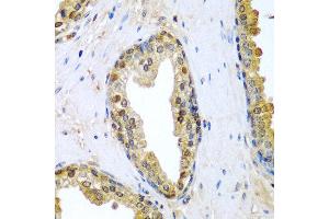 Immunohistochemistry of paraffin-embedded human prostate using TNFSF10 antibody at dilution of 1:200 (40x lens).