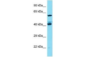 Western Blotting (WB) image for anti-KIAA1841 (KIAA1841) (C-Term) antibody (ABIN2791620) (KIAA1841 Antikörper  (C-Term))