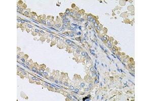 Immunohistochemistry of paraffin-embedded Human prostate using PPIC Polyclonal Antibody at dilution of 1:100 (40x lens). (PPIC Antikörper)