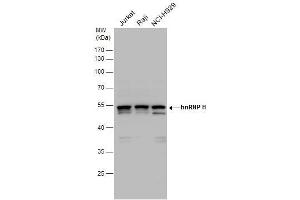 Western Blotting (WB) image for anti-Heterogeneous Nuclear Ribonucleoprotein H1 (H) (HNRNPH1) antibody (ABIN2855275)