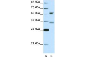 Western Blotting (WB) image for anti-Regulatory Factor X 4 (RFX4) antibody (ABIN2460674) (RFX4 Antikörper)