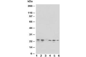 Western blot testing of HSPB1 antibody and Lane 1:  rat liver;  and human samples 2: HeLa;  3: MCF-7;  4: HT1080;  5: COLO320 cell lysate. (HSP27 Antikörper  (Middle Region))