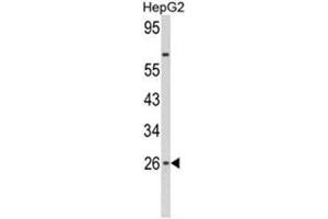 Western blot analysis of IFNB1 Antibody (N-term) in HepG2 cell line lysates (35ug/lane). (IFNB1 Antikörper  (N-Term))