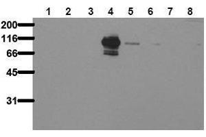 Western Blotting (WB) image for anti-PTK2B Protein tyrosine Kinase 2 beta (PTK2B) (pTyr402) antibody (ABIN126880) (PTK2B Antikörper  (pTyr402))