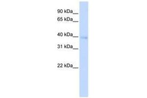 Image no. 1 for anti-Homeobox A11 (HOXA11) (AA 144-193) antibody (ABIN6741430) (Homeobox A11 Antikörper  (AA 144-193))