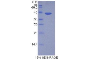SDS-PAGE (SDS) image for Histone Cluster 1, H2ad (HIST1H2AD) (AA 2-130) protein (His tag,GST tag) (ABIN1878264)