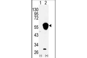 Image no. 1 for anti-Aldehyde Dehydrogenase 3 Family, Member A1 (ALDH3A1) (N-Term) antibody (ABIN360202)
