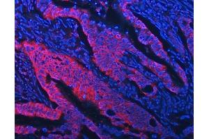 IF analysis of STON1 using anti-STON1 antibody (ABIN7599896).