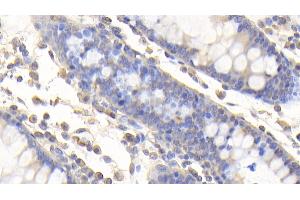 Detection of vWA2 in Human Colon Tissue using Polyclonal Antibody to Von Willebrand Factor A Domain Containing Protein 2 (vWA2) (VWA2 Antikörper  (AA 457-708))