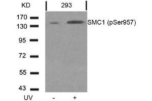 Western blot analysis of extracts from 293 cells untreated or treated with UV using SMC1(Phospho-Ser957) Antibody. (SMC1A Antikörper  (pSer957))