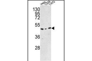 Western blot analysis of C9orf156 Antibody (C-term) (ABIN390925 and ABIN2841127) in Hela, CEM, T47D cell line lysates (35 μg/lane). (C9orf156 Antikörper  (C-Term))