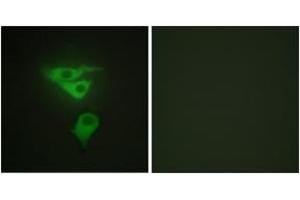 Immunofluorescence analysis of HepG2 cells, using PDLIM1 Antibody. (PDLIM1 Antikörper  (AA 61-110))